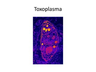 Toxoplasma
 
