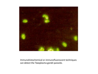 Immunohistochemical or immunofluorescent techniques
can detect the Toxoplasma gondii parasite.
 
