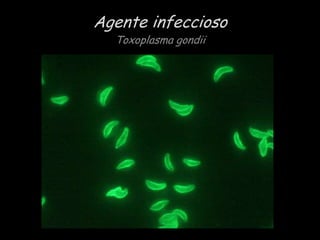 Agente infeccioso
Toxoplasma gondii

 