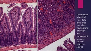 Undamaged
intestinal
wall (left)
Intestinal
wall after
Toxoplasma
infection
and
subsequent
immune
system
reaction
(right)
 