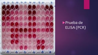 Prueba de
ELISA (PCR)
 