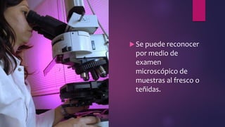 Se puede reconocer
por medio de
examen
microscópico de
muestras al fresco o
teñidas.
 