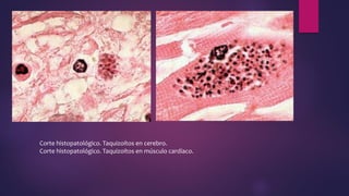 Corte histopatológico. Taquizoítos en cerebro.
Corte histopatológico. Taquizoítos en músculo cardíaco.
 