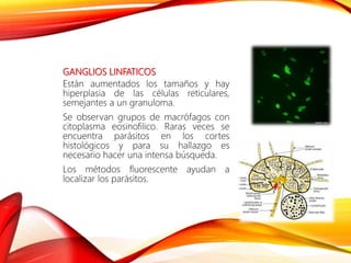 GANGLIOS LINFATICOS
Están aumentados los tamaños y hay
hiperplasia de las células reticulares,
semejantes a un granuloma.
Se observan grupos de macrófagos con
citoplasma eosinofilico. Raras veces se
encuentra parásitos en los cortes
histológicos y para su hallazgo es
necesario hacer una intensa búsqueda.
Los métodos fluorescente ayudan a
localizar los parásitos.
 