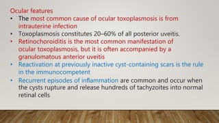 Ocular features
• The most common cause of ocular toxoplasmosis is from
intrauterine infection
• Toxoplasmosis constitutes 20–60% of all posterior uveitis.
• Retinochoroiditis is the most common manifestation of
ocular toxoplasmosis, but it is often accompanied by a
granulomatous anterior uveitis
• Reactivation at previously inactive cyst-containing scars is the rule
in the immunocompetent
• Recurrent episodes of inﬂammation are common and occur when
the cysts rupture and release hundreds of tachyzoites into normal
retinal cells
 