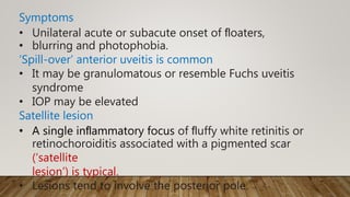 Symptoms
• Unilateral acute or subacute onset of ﬂoaters,
• blurring and photophobia.
‘Spill-over’ anterior uveitis is common
• It may be granulomatous or resemble Fuchs uveitis
syndrome
• IOP may be elevated
Satellite lesion
• A single inﬂammatory focus of ﬂuffy white retinitis or
retinochoroiditis associated with a pigmented scar
(‘satellite
lesion’) is typical.
• Lesions tend to involve the posterior pole.
 
