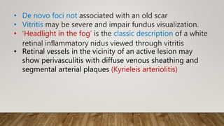• De novo foci not associated with an old scar
• Vitritis may be severe and impair fundus visualization.
• ‘Headlight in the fog’ is the classic description of a white
retinal inﬂammatory nidus viewed through vitritis
• Retinal vessels in the vicinity of an active lesion may
show perivasculitis with diffuse venous sheathing and
segmental arterial plaques (Kyrieleis arteriolitis)
 
