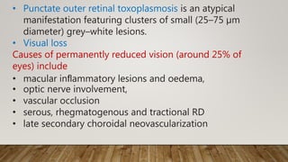 • Punctate outer retinal toxoplasmosis is an atypical
manifestation featuring clusters of small (25–75 µm
diameter) grey–white lesions.
• Visual loss
Causes of permanently reduced vision (around 25% of
eyes) include
• macular inﬂammatory lesions and oedema,
• optic nerve involvement,
• vascular occlusion
• serous, rhegmatogenous and tractional RD
• late secondary choroidal neovascularization
 