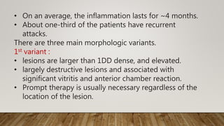 • On an average, the inflammation lasts for ~4 months.
• About one-third of the patients have recurrent
attacks.
There are three main morphologic variants.
1st variant :
• lesions are larger than 1DD dense, and elevated.
• largely destructive lesions and associated with
significant vitritis and anterior chamber reaction.
• Prompt therapy is usually necessary regardless of the
location of the lesion.
 