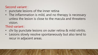 Second variant :
• punctate lesions of the inner retina
• The inflammation is mild, and no therapy is necessary
unless the lesion is close to the macula and threatens
vision.
Third variant :
• chr by punctate lesions on outer retina & mild vitritis.
• Lesions slowly resolve spontaneously but also tend to
recur in adjacent areas.
 