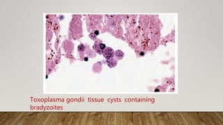 Toxoplasma gondii tissue cysts containing
bradyzoites
 