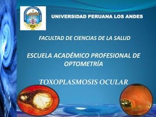 UNIVERSIDAD PERUANA LOS ANDES

FACULTAD DE CIENCIAS DE LA SALUD

ESCUELA ACADÉMICO PROFESIONAL DE
OPTOMETRÍA
TOXOPLASMOSIS OCULAR

 