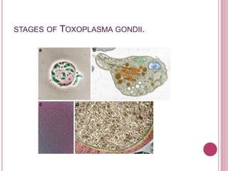 STAGES OF TOXOPLASMA GONDII.
 