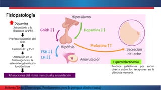 Dopamina
Fisiopatología
Alteración en la
foliculogénesis, la
esteroideogénesis y la
función lútea Produce galactorrea por acción
directa sobre los receptores en la
glándula mamaria.
Hiperprolactinemia
Provoca trastornos del
ciclo
Secundario a la
elevación de PRL
Cambios LH y FSH
Alteraciones del ritmo menstrual y anovulación
Roberto Testa. Ginecología. Fundamentos para la práctica clínica (2012)
 