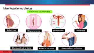 Manifestaciones clínicas
sintomática o asintomática
Galactorrea Oligoamenorrea polímenorrea Infertilidad
Disminución de la libido Pubertad retrasada Hipogonadismo en hombre
Roberto Testa. Ginecología. Fundamentos para la práctica clínica (2012)
 