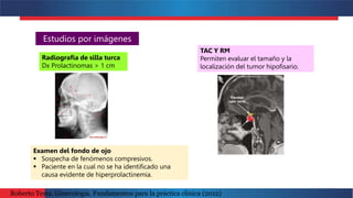Estudios por imágenes
Radiografía de silla turca
Dx Prolactinomas > 1 cm
TAC Y RM
Permiten evaluar el tamaño y la
localización del tumor hipofisario.
Examen del fondo de ojo
 Sospecha de fenómenos compresivos.
 Paciente en la cual no se ha identificado una
causa evidente de hiperprolactinemia.
Roberto Testa. Ginecología. Fundamentos para la práctica clínica (2012)
 