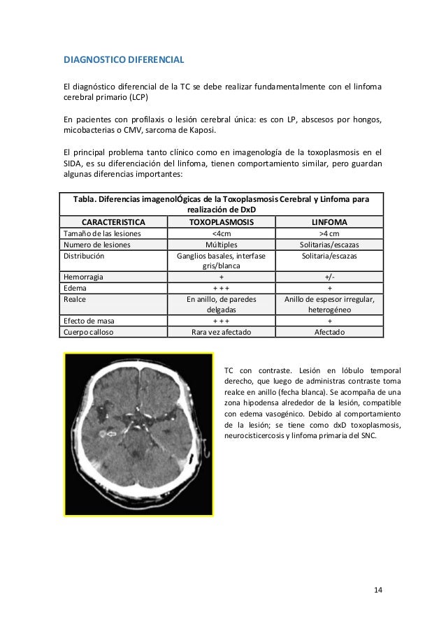 toxoplasmosis lesiones
