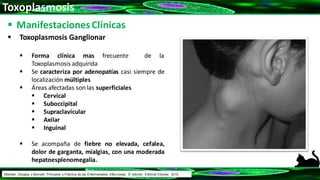 Toxoplasmosis
 ManifestacionesClínicas
 Toxoplasmosis Ganglionar
 Forma clínica mas frecuente de la
Toxoplasmosis adquirida
 Se caracteriza por adenopatías casi siempre de
localización múltiples
 Áreas afectadas son las superficiales
 Cervical
 Suboccipital
 Supraclavicular
 Axilar
 Inguinal
 Se acompaña de fiebre no elevada, cefalea,
dolor de garganta, mialgias, con una moderada
hepatoesplenomegalia.
Mandell, Douglas y Bennett: Principios y Práctica de las Enfermedades Infecciosas. 8° edición. Editorial Elsevier. 2015.
 