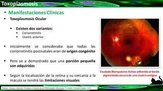 Toxoplasmosis
 ManifestacionesClínicas
 Toxoplasmosis Ocular
 Existen dos variantes:
 Coriorretinitis
 Uveitis anterior
 Inicialmente se consideraba que todas las
coriorretinitis postnatales eran de origen congénito
 Pero se a demostrado que una porción pequeña
son adquiridas
 Según la localización de la retina y su cercanía a la
mácula se tendrá las limitaciones visuales
Exudado Blanquecino Activo adherido al borde
pigmentado oscurode una cicatriz antigua
Mandell, Douglas y Bennett: Principios y Práctica de las Enfermedades Infecciosas. 8° edición. Editorial Elsevier. 2015.
 