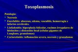 ToxoplasmosisToxoplasmosis
Patología:Patología:
 NecrosisNecrosis
 Encefalitis: abscesos, edema, vasculitis, hemorragia eEncefalitis: abscesos, edema, vasculitis, hemorragia e
infartos cerebrales.infartos cerebrales.
 Linfadenitis: hiperplasia folicular, racimos irregulares deLinfadenitis: hiperplasia folicular, racimos irregulares de
histiocitos y distensión focal (células gigantes dehistiocitos y distensión focal (células gigantes de
Langhans, granulomas)Langhans, granulomas)
 Corioretinitis: inflamación severa, necrosis y granulomasCorioretinitis: inflamación severa, necrosis y granulomas
 