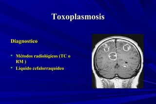 ToxoplasmosisToxoplasmosis
DiagnosticoDiagnostico
 Métodos radiológicos (TC oMétodos radiológicos (TC o
RM )RM )
 Liquido cefalorraquídeoLiquido cefalorraquídeo
 