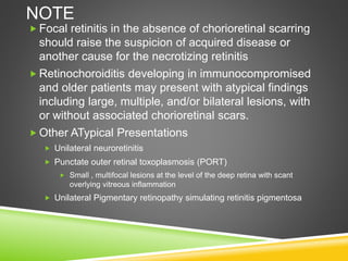NOTE
 Focal retinitis in the absence of chorioretinal scarring
should raise the suspicion of acquired disease or
another cause for the necrotizing retinitis
 Retinochoroiditis developing in immunocompromised
and older patients may present with atypical findings
including large, multiple, and/or bilateral lesions, with
or without associated chorioretinal scars.
 Other ATypical Presentations
 Unilateral neuroretinitis
 Punctate outer retinal toxoplasmosis (PORT)
 Small , multifocal lesions at the level of the deep retina with scant
overlying vitreous inflammation
 Unilateral Pigmentary retinopathy simulating retinitis pigmentosa
 