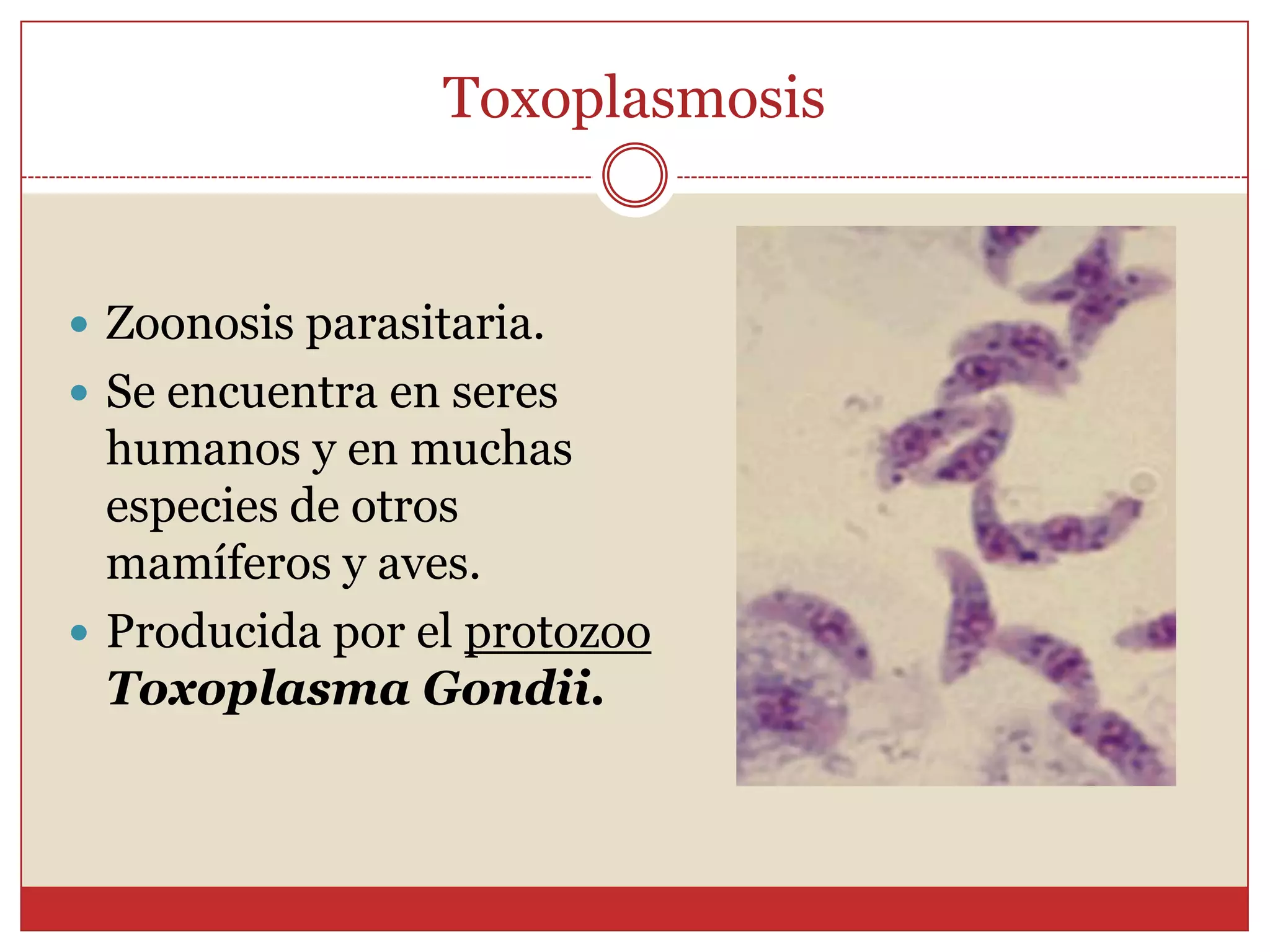 TOXOPLASMOSIS
