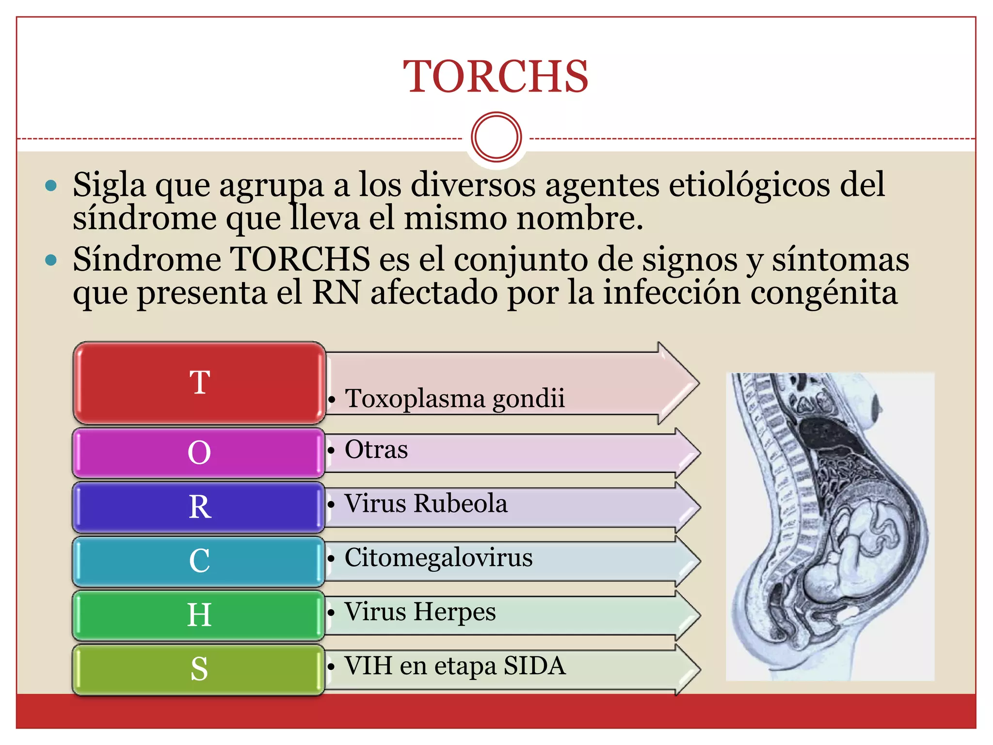 TORCHSSigla que agrupa a los diversos agentes etiológicos del síndrome que lleva el mismo nombre.Síndrome TORCHS es el conjunto de signos y síntomas que presenta el RN afectado por la infección congénita