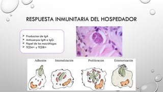 RESPUESTA INMUNITARIA DEL HOSPEDADOR
 Produccion de IgA
 Anticuerpos IgM e IgG
 Papel de los macrófagos
 TCD4+ y TCD8+
 