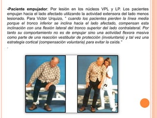 -Paciente empujador: Por lesión en los núcleos VPL y LP. Los pacientes 
empujan hacia el lado afectado utilizando la actividad extensora del lado menos 
lesionado. Para Victor Urquizo, ” cuando los pacientes pierden la línea media 
porque el tronco inferior se inclina hacia el lado afectado, compensan esta 
inclinación con una flexión lateral del tronco superior del lado contralateral. Por 
tanto su comportamiento no es de empujar sino una actividad flexora masiva 
como parte de una reacción vestibular de protección (involuntaria) y tal vez una 
estrategia cortical (compensación voluntaria) para evitar la caída.” 
. 
 