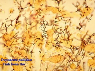 1
Treponema pallidum
- Tinh hoàn thỏ
 