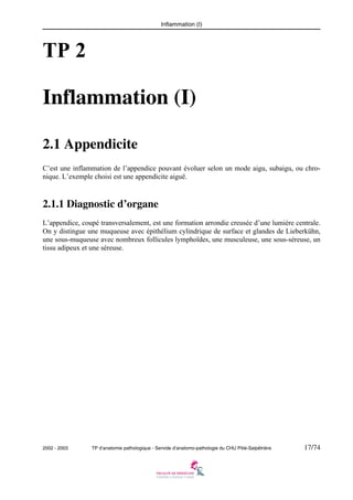 Inflammation (I)

TP 2
Inflammation (I)
2.1 Appendicite
C’est une inflammation de l’appendice pouvant évoluer selon un mode aigu, subaigu, ou chronique. L’exemple choisi est une appendicite aiguë.

2.1.1 Diagnostic d’organe
L’appendice, coupé transversalement, est une formation arrondie creusée d’une lumière centrale.
On y distingue une muqueuse avec épithélium cylindrique de surface et glandes de Lieberkühn,
une sous-muqueuse avec nombreux follicules lymphoïdes, une musculeuse, une sous-séreuse, un
tissu adipeux et une séreuse.

2002 - 2003

TP d’anatomie pathologique - Servide d’anatomo-pathologie du CHU Pitié-Salpêtrière

17/74

 