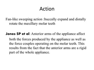 Action
Fan-like sweeping action :buccally expand and distally
rotate the maxillary molar teeth
Jones SP et al: Anterior arms of the appliance affect
both the forces produced by the appliance as well as
the force couples operating on the molar teeth. This
results from the fact that the anterior arms are a rigid
part of the whole appliance.
 