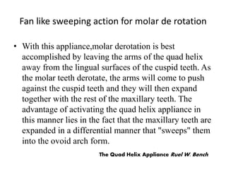 Fan like sweeping action for molar de rotation
• With this appliance,molar derotation is best
accomplished by leaving the arms of the quad helix
away from the lingual surfaces of the cuspid teeth. As
the molar teeth derotate, the arms will come to push
against the cuspid teeth and they will then expand
together with the rest of the maxillary teeth. The
advantage of activating the quad helix appliance in
this manner lies in the fact that the maxillary teeth are
expanded in a differential manner that "sweeps" them
into the ovoid arch form.
The Quad Helix Appliance Ruel W. Bench
 