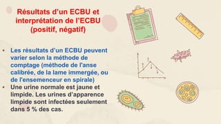Résultats d’un ECBU et
interprétation de l’ECBU
(positif, négatif)
 Les résultats d’un ECBU peuvent
varier selon la méthode de
comptage (méthode de l'anse
calibrée, de la lame immergée, ou
de l'ensemenceur en spirale)
 Une urine normale est jaune et
limpide. Les urines d’apparence
limpide sont infectées seulement
dans 5 % des cas.
 