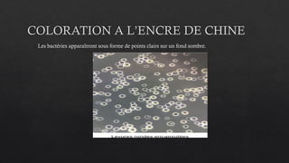 COLORATION A L’ENCRE DE CHINE
Les bactéries apparaîtront sous forme de points clairs sur un fond sombre.
 