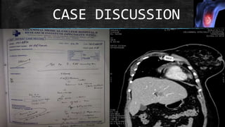 CASE DISCUSSION
 
