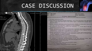 CASE DISCUSSION
 