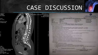 CASE DISCUSSION
 