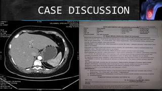 CASE DISCUSSION
 