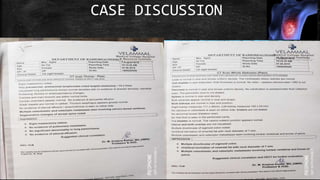 CASE DISCUSSION
 