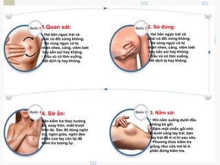 1.Quan sát:
• Hai bên ngực trái và
phải có đối xứng không;
• Da vùng ngực có bị
nhăn nheo, căng, viêm loét
hay sần sùi hay không;
• Đầu vú có lõm xuống,
tiết dịch lạ hay không.
2. Sờ đứng:
• Hai bên ngực trái và
phải có đối xứng không;
• Da vùng ngực có bị
nhăn nheo, căng, viêm loét
hay sần sùi hay không;
• Đầu vú có lõm xuống,
tiết dịch lạ hay không.
4. Sờ ấn:
Nên kiểm tra theo hướng
ấn, xoay tròn, miết trượt
trên da. Sau đó dùng ngón
trỏ, ngón giữa, ngón đeo
nhẫn của tay còn lại để
kiểm tra tương tự.
3. Nằm sờ:
• Khi nằm xuống dưới đầu
không kê gối.
• Đệm một chiếc gối nhỏ
ở dưới cẳng tay trái, bàn
tay trái để ở vị trí sau não.
• Phương thức kiểm tra
giống như vừa mô tả ở
phần đứng kiểm tra.
 