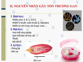 II. NGUYÊN NHÂN GÂY TỔN THƯƠNG GAN
1. Sinh h c:ọ
- Nhi m virus: A, B, C, D,E,Gễ
- Nhi m vi khu n: xo n khu n,ễ ẩ ắ ẩ ∑, leptospira
- Nhi m ký sinh trùng: sán lá gan, amip ....ễ
2. Hoá h c:ọ
- Hoá ch t công nghi pấ ệ
- Hoá ch t b o v th c v t.ấ ả ệ ự ậ
- Thu cố
- N i ti t tộ ế ố
3. Lý h c:ọ
- Phóng xạ
- B c xứ ạ
Sán lá gan
 