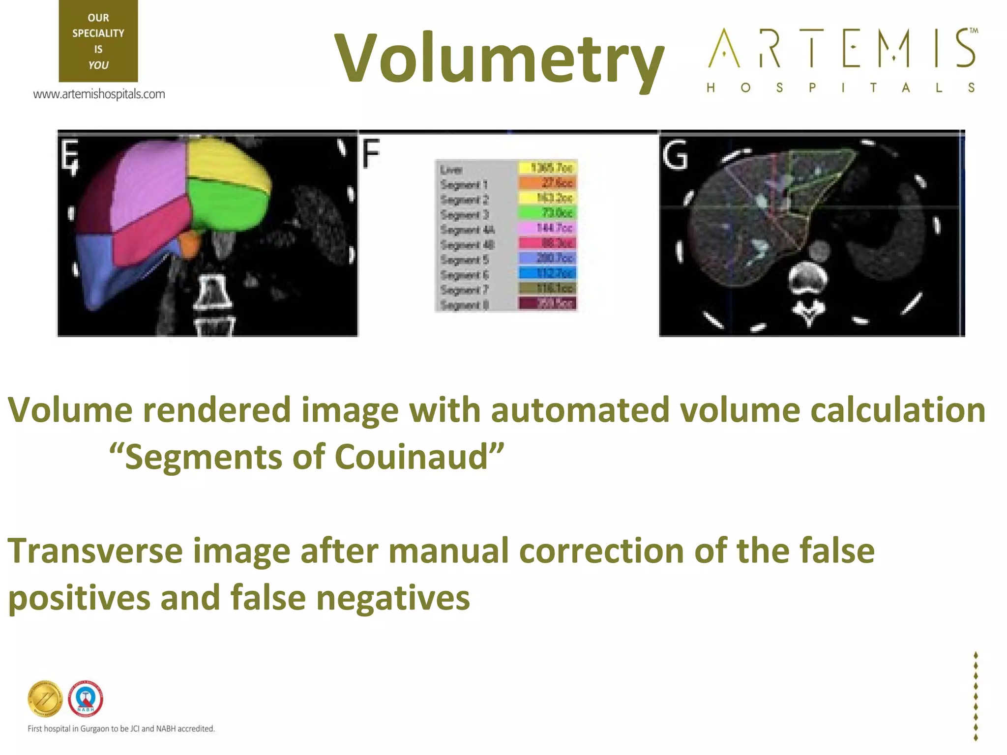 TPCT - Triphasic CT Scan - Liver | PPT