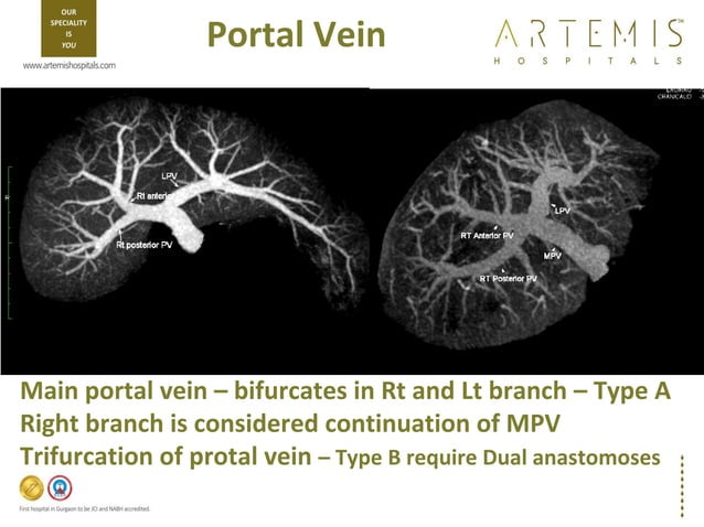 TPCT - Triphasic CT Scan - Liver | PPT