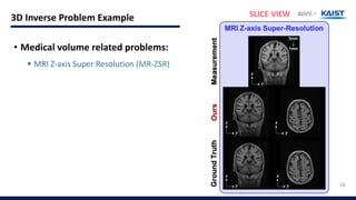 Mri Inverse Problem TPDM Presentation Slide (ICCV23) | PDF