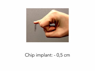 Chip implant: - 0,5 cm
 