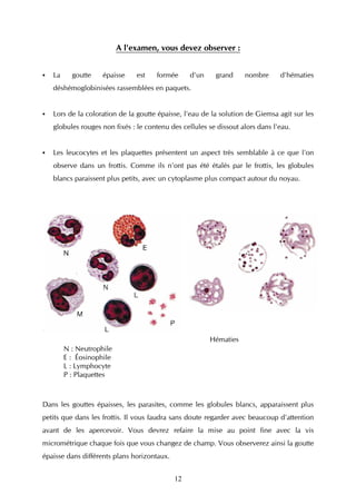 A l'examen, vous devez observer :


   La     goutte    épaisse    est   formée       d'un    grand     nombre     d'hématies
   déshémoglobinisées rassemblées en paquets.


   Lors de la coloration de la goutte épaisse, l'eau de la solution de Giemsa agit sur les
   globules rouges non fixés : le contenu des cellules se dissout alors dans l'eau.


   Les leucocytes et les plaquettes présentent un aspect très semblable à ce que l'on
   observe dans un frottis. Comme ils n'ont pas été étalés par le frottis, les globules
   blancs paraissent plus petits, avec un cytoplasme plus compact autour du noyau.




                                                         Hématies
        N : Neutrophile
        E : Éosinophile
        L : Lymphocyte
        P : Plaquettes



Dans les gouttes épaisses, les parasites, comme les globules blancs, apparaissent plus
petits que dans les frottis. Il vous faudra sans doute regarder avec beaucoup d'attention
avant de les apercevoir. Vous devrez refaire la mise au point fine avec la vis
micrométrique chaque fois que vous changez de champ. Vous observerez ainsi la goutte
épaisse dans différents plans horizontaux.


                                             12
 