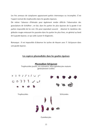 Les fins anneaux de cytoplasme apparaissent parfois interrompus ou incomplets. C'est
l'aspect normal des trophozoïtes dans les gouttes épaisses.
De même l'absence d'hématie peut également rendre difficile l'observation des
granulations de Schüffner ; en fait, dans les parties les plus épaisses de la goutte il est
parfois impossible de les voir. On peut cependant souvent       observer le «fantôme» des
globules rouges entourant les parasites dans les parties les plus fines, en général au bord
de la goutte épaisse, ce qui aide à poser le diagnostic.


Remarque : Il est impossible d'observer les taches de Maurer avec P. falciparum dans
une goutte épaisse.




               Les espèces plasmodiales dans les gouttes épaisses


                               Plasmodium falciparum
             Trophozoïtes jeunes, en croissance, et/ou gamétocytes matures
                                 généralement visibles




        Trophozoïtes                                           Schizontes




                                       Gamétocytes


                                            13
 