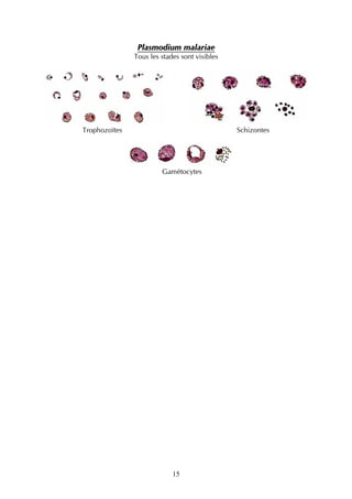 Plasmodium malariae
               Tous les stades sont visibles




Trophozoïtes                                   Schizontes




                        Gamétocytes




                            15
 